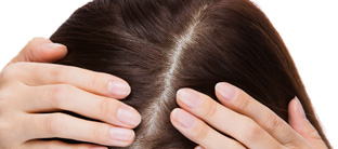 施術 毛髪 写真